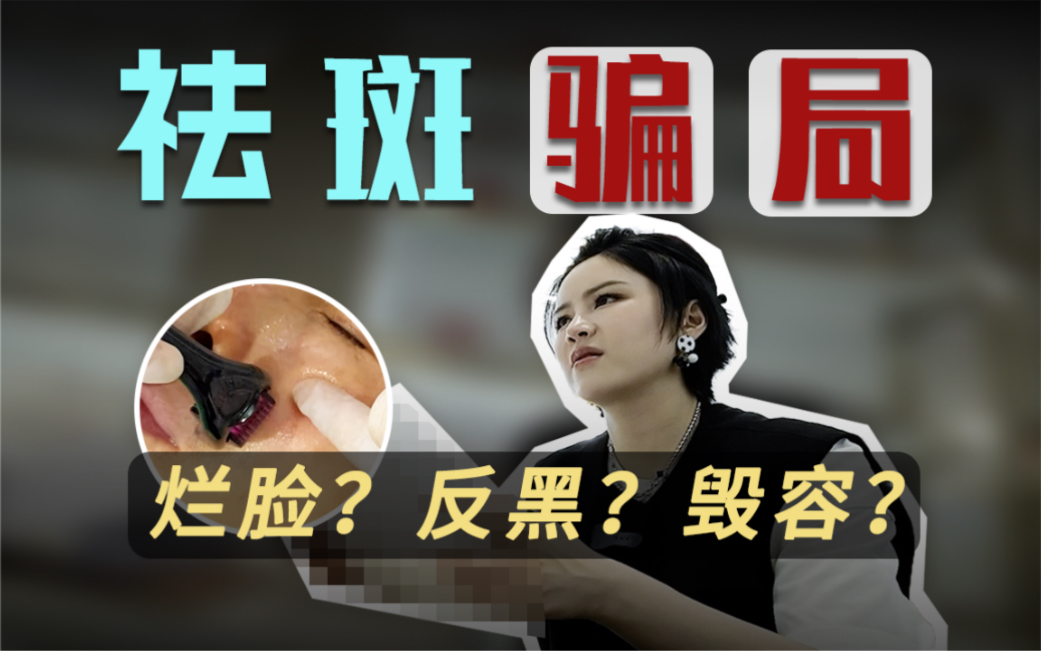 小心这些“神奇祛斑药水”！滴上去可能会挖走你脸上的肉！