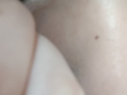 14.5mm大直径微眸第一次戴