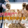 连体姐妹花变白骨，探员抽丝剥茧查真凶，发现起因竟是一条钢丝