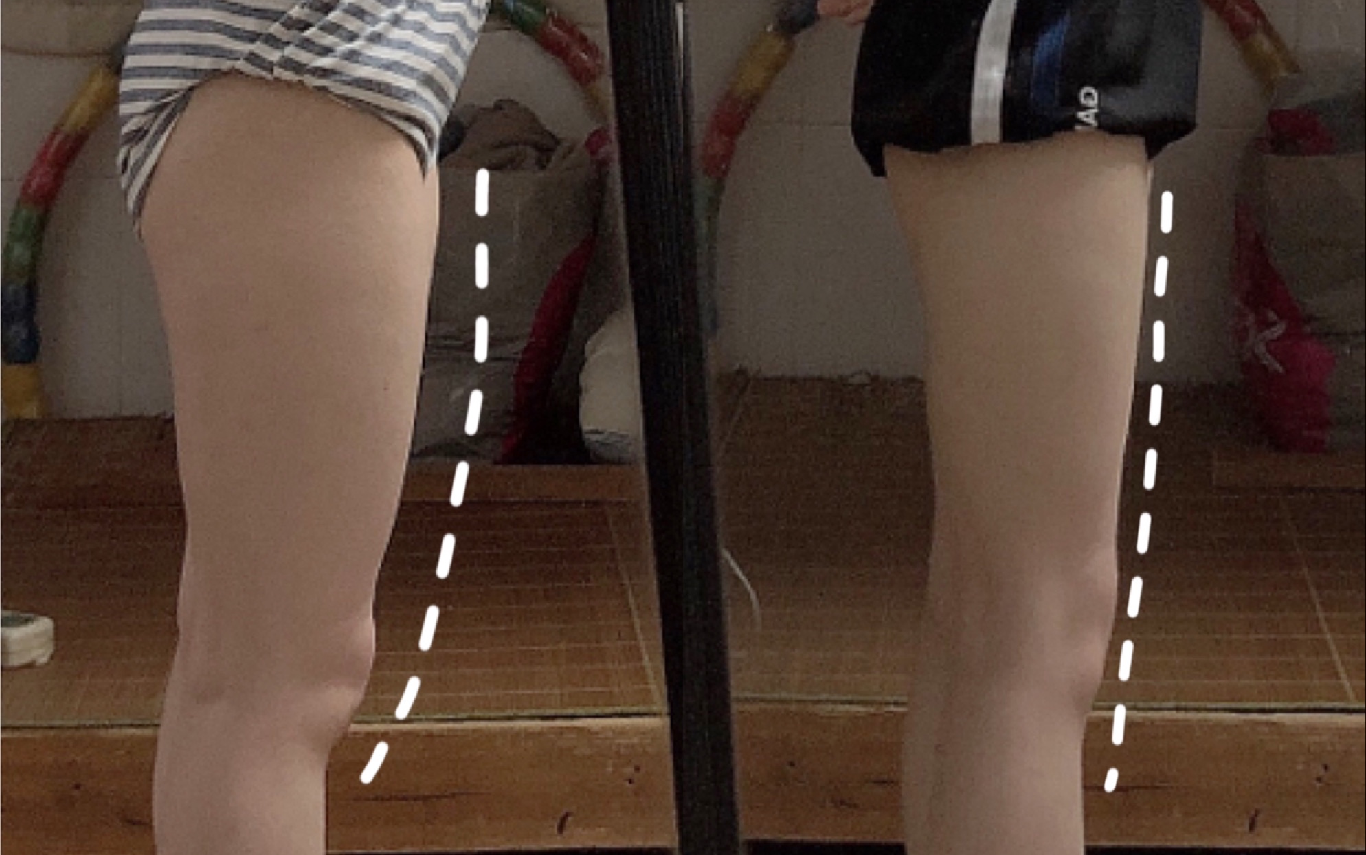 减大腿前侧突出｜6cm的变化 从最简单的开始