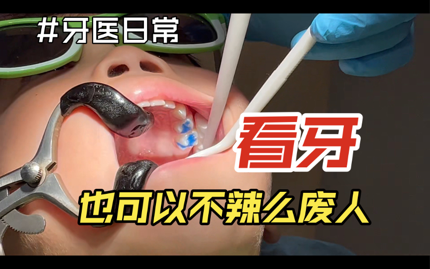 「儿牙医生的秘密武器」之没有一句废话的“话唠”才是真的厉害！