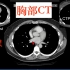 胸部CT - 影像学解剖