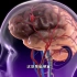 脑中风 脑梗塞 脑出血都是啥，3D演示。。