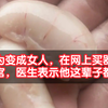 小伙为变成女人，在网上买器械回家自宫，医生表示他这辈子都完了