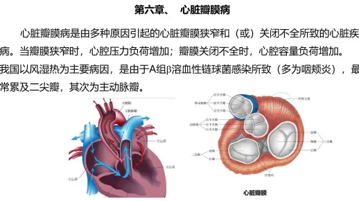 4、心脏瓣膜病1--二尖瓣疾病