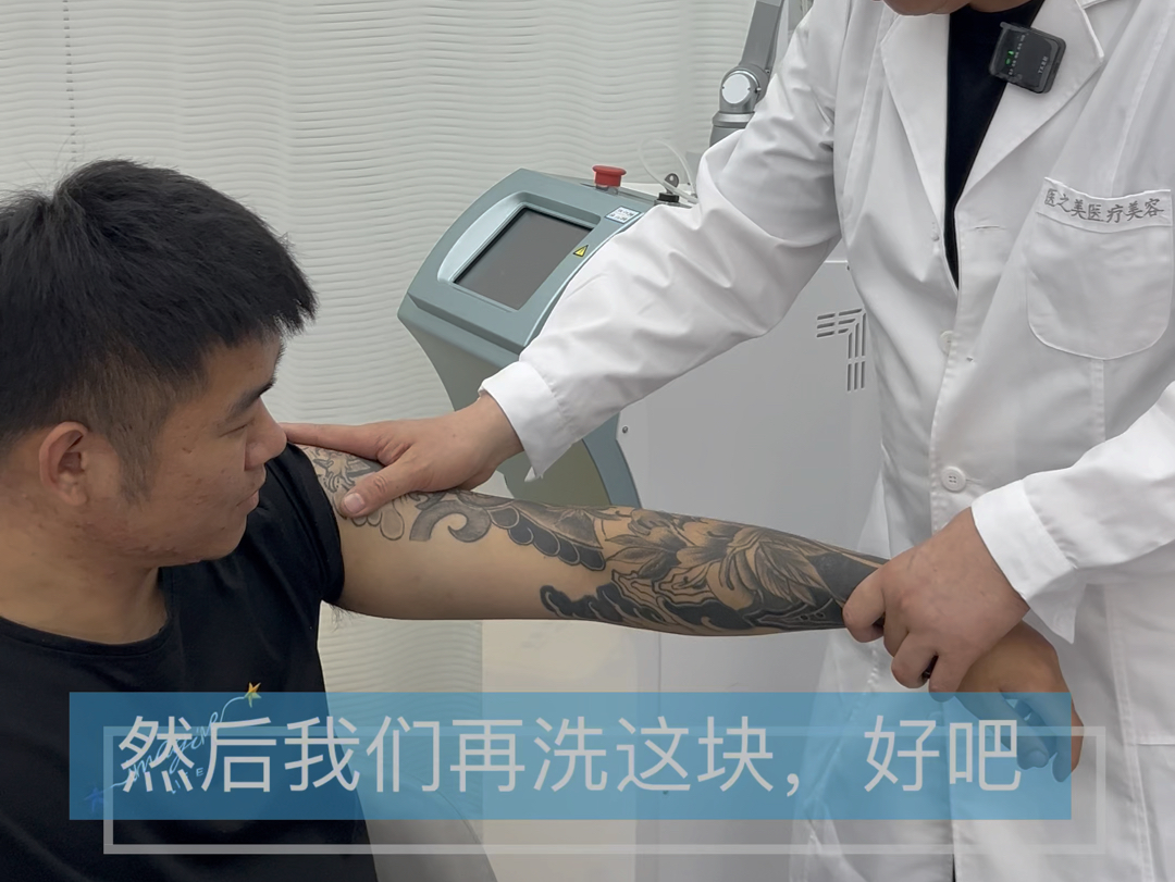 洗一条花臂纹身算不算大工程，从徐州到常州医之美医美洗纹身的帅哥，20岁就干了一个大花臂