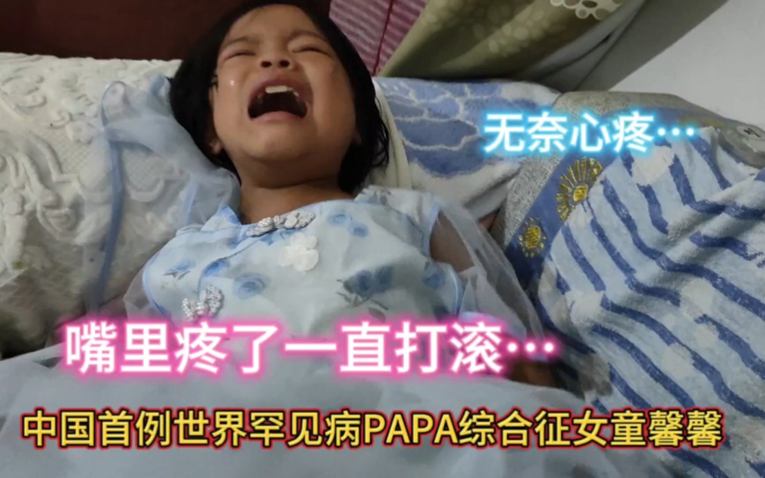 中国首例世界罕见病PAPA综合征馨馨，无奈馨馨嘴里疼了一直哭一直打滚…病在儿身痛在母心，真希望馨馨快点好起来
