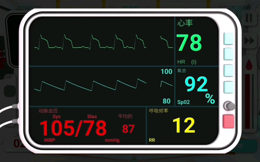 真实医疗模拟器：急性心肌梗塞——救治不及时——心脏停搏——抢救——恢复心跳，到达医院         心脏停搏那一段我也没弄清楚怎么这么快，求大佬解释