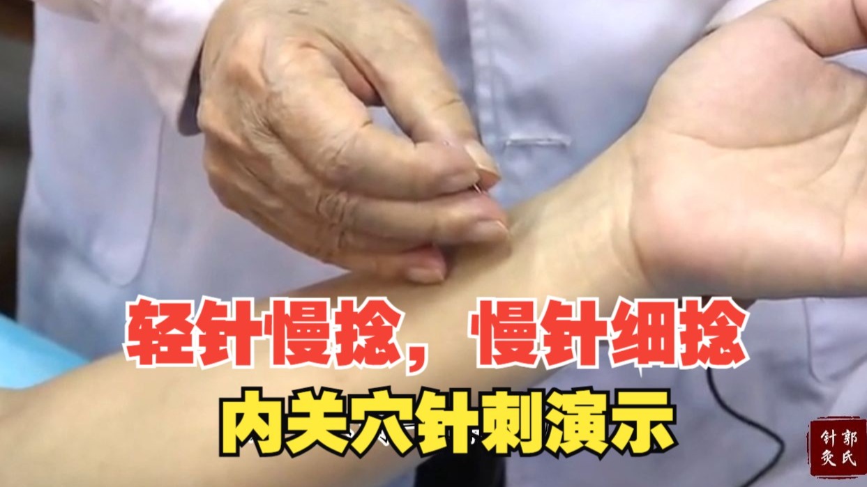 针刺内关穴，演示'轻针慢捻，慢针细捻'