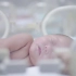 《东方朝阳》──中国首部新生儿医学纪录电影