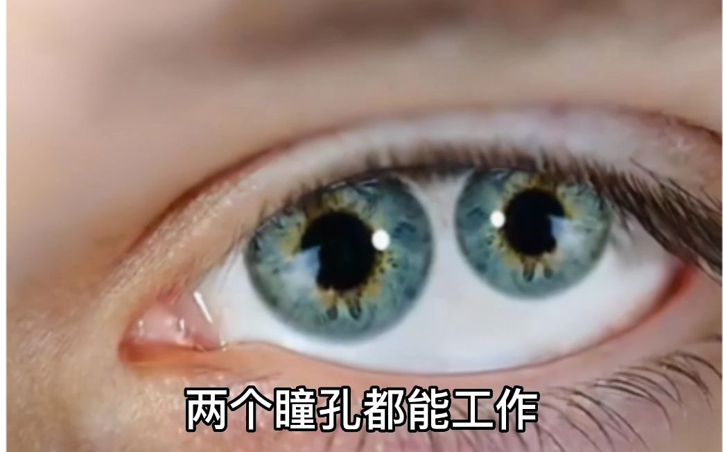 双瞳孔的人真是存在，你相信吗，他们又有什么特别之处呢