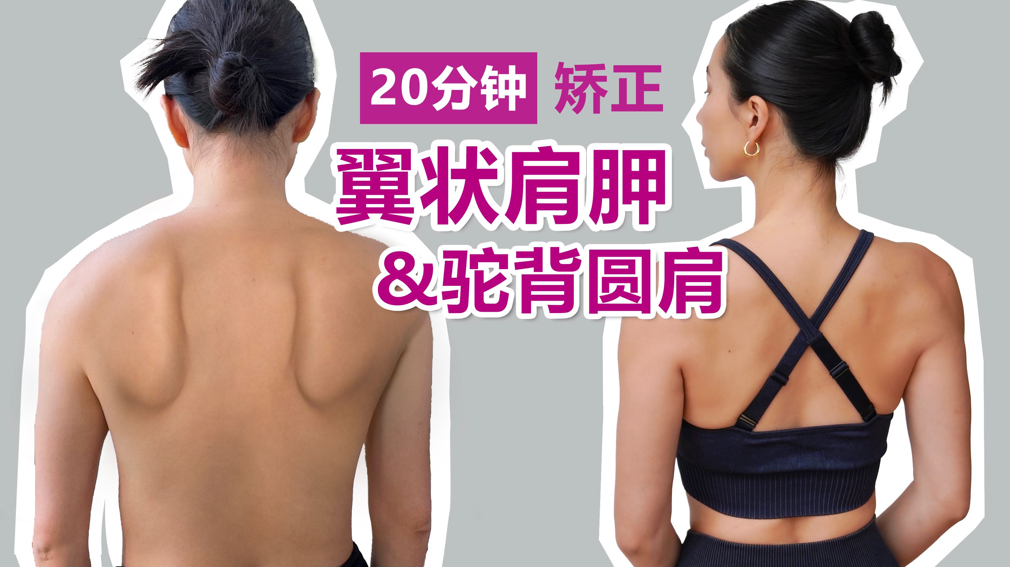 20分钟矫正翼状肩胛&圆肩驼背｜改善肩背运动【周六野Zoey】