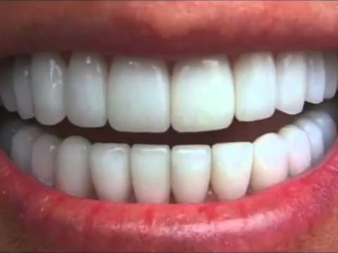 AKUO:获得完美整齐的牙齿―>> 肯定语| 治疗覆牙合、反牙合和反牙合