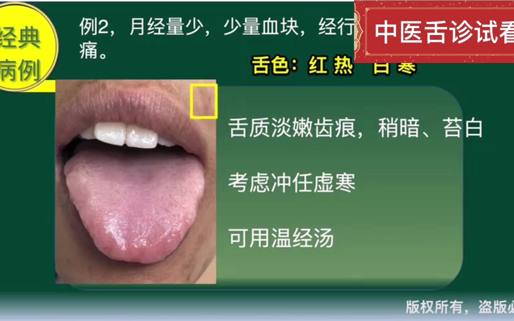 从舌苔看健康，跟中医学舌诊，这7种要注意-搜狐大视野-搜狐新闻