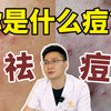 “医生，我的痘痘为啥反反复复长出来？”粉刺、黑头、酒糟鼻、青春痘，不同类型的痘痘到底应该怎么治？皮肤科医生手把手教你