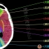 2.颅脑CT解剖图谱-血供分区CT解剖