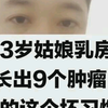 23岁姑娘乳房长出9个肿瘤，她的这个坏习惯为所有人敲响警钟