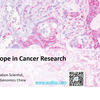 ACD RNAscope in Cancer Research