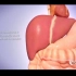 肝移植3D动画演示