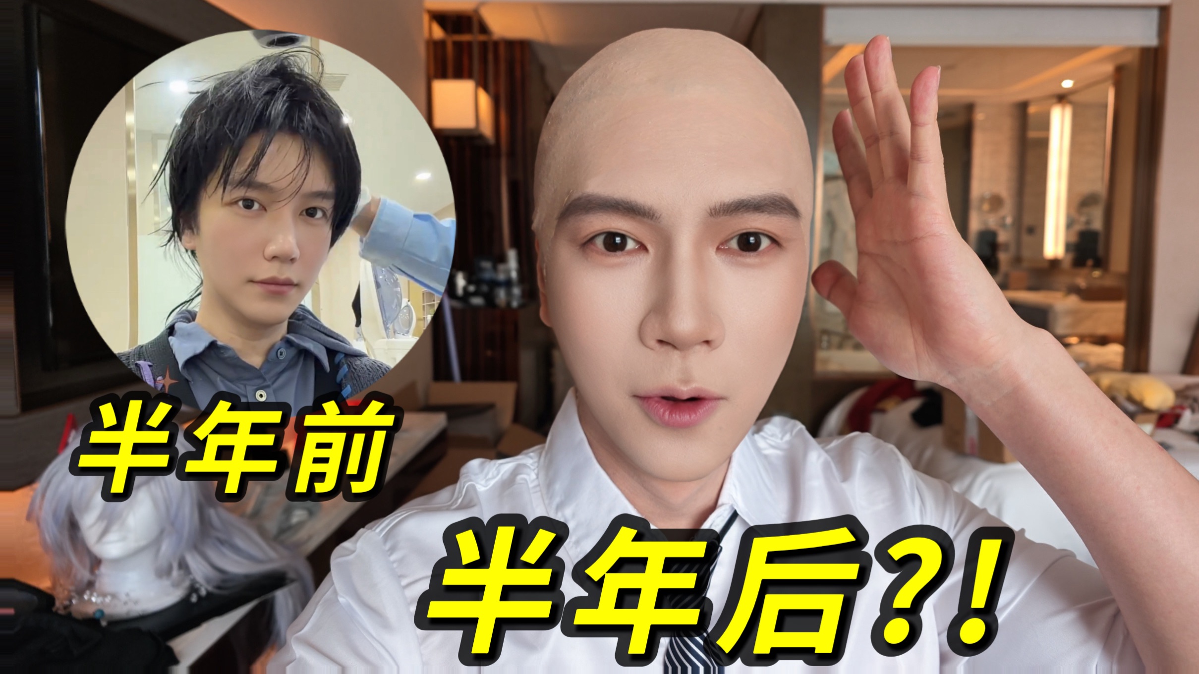 植发半年我变成了光头？！