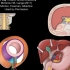 【消化系统解剖学】腹膜解剖结构 Peritoneum tutorial 男女性对比 生理学意义｜浆液 腹膜腔 ｜腹膜内间