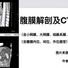 详细分解腹膜解剖及CT(下
