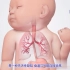 3D医学视频：新生儿先天畸形——气管食管瘘