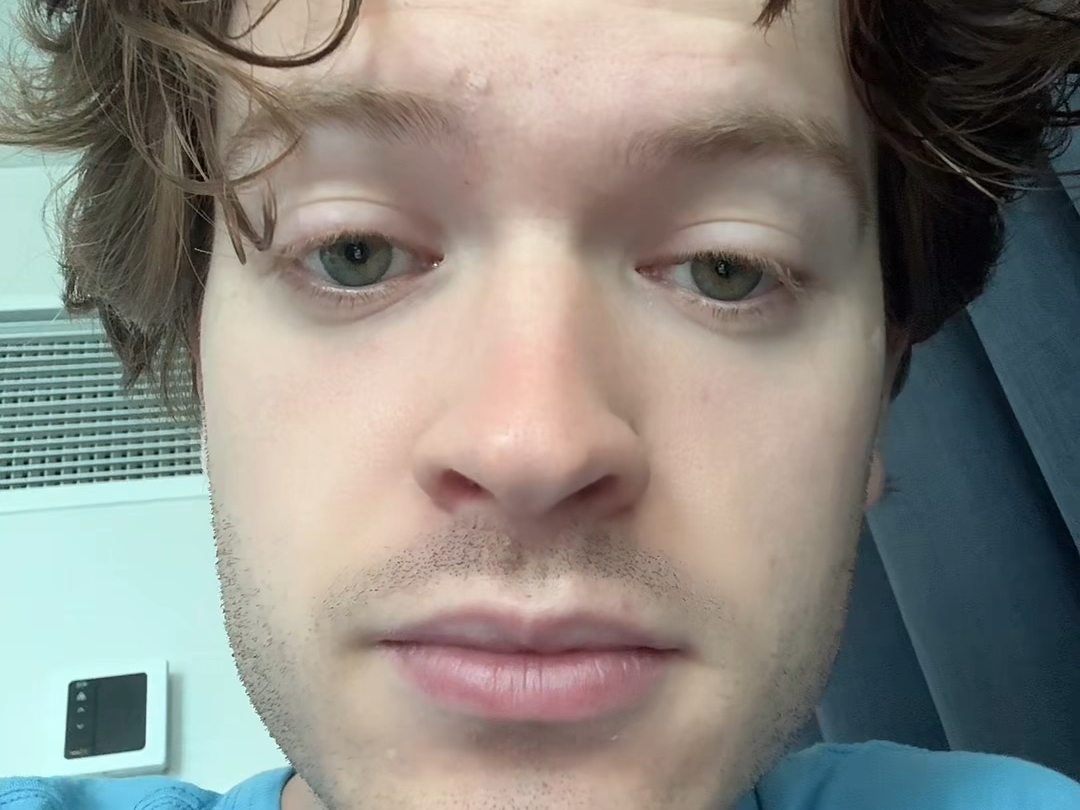 每天睡眠时间少于八小时身体会有哪些变化？