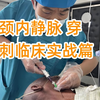 5 苏伟：颈内静脉穿刺的技术要点（进针技巧