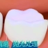 3D模拟蛀牙修补