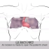 胸腔都被劈成两半了，肺移植过程，3D演示。。