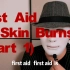 First aid on skin burns—— Part one1