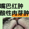 猫嘴巴红肿，嗜酸性肉芽肿