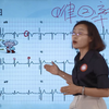 心电图-正常心电图