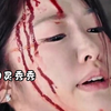 艺考前夕父母竟派人打断女儿的双腿，甚至央求医生一定要让手术失败