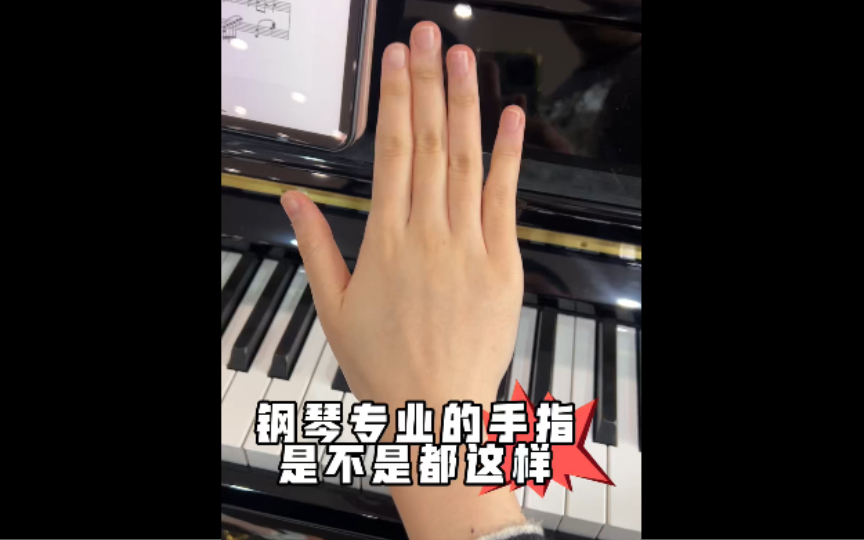 钢琴专业的手指是不是都这样