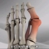 大脚骨矫正手术过程，3D演示。。