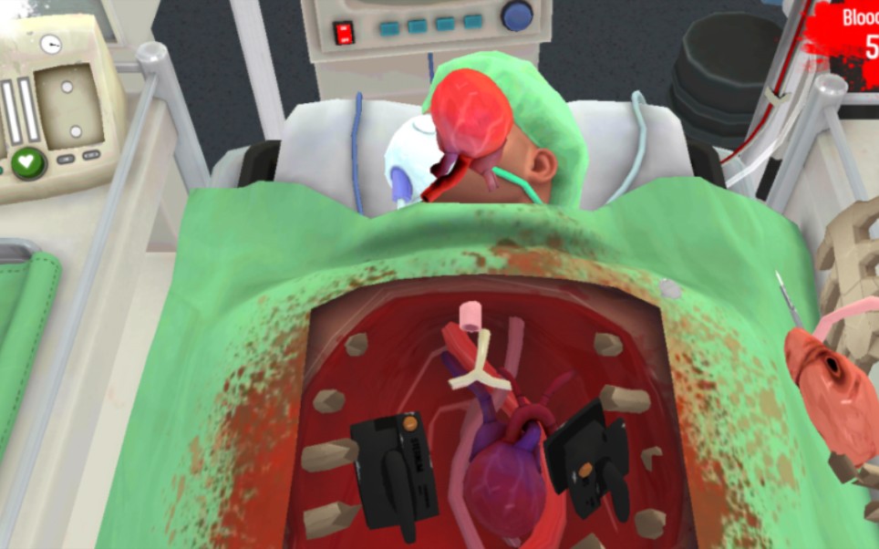 外科模拟手术游戏（手机版）手术室心脏移植教程