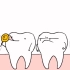 韩国动画短片蛀牙，看完你还敢不爱护自己的牙齿吗？