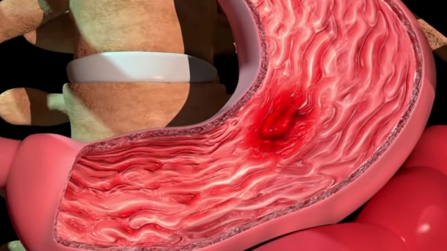 你好，我是你的胃，希望你爱我