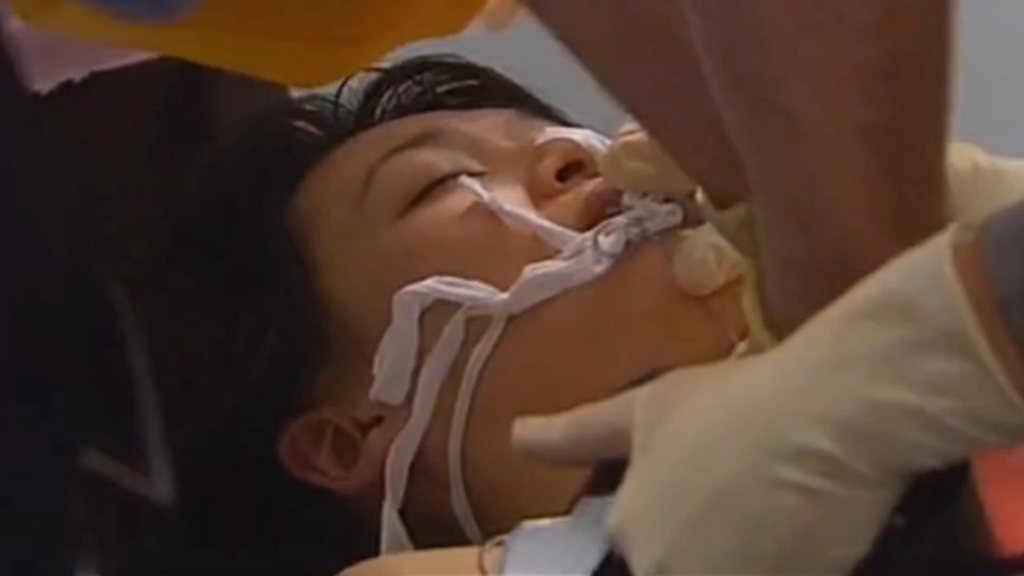 心胀骤停抢救cpr