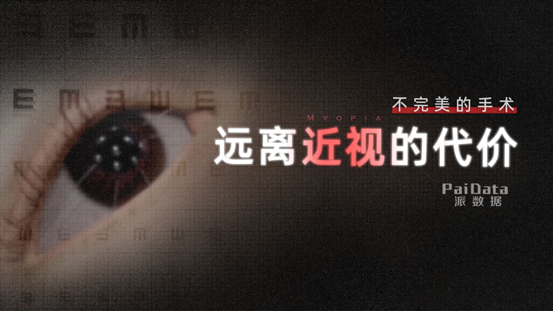 不完美的近视手术：远离近视的代价是什么