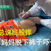 男孩总是说屁股痒，妈妈脱下裤子吓一跳！#白癜风# #白斑