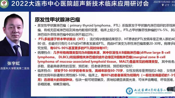甲状腺不常见恶性肿瘤超声诊断