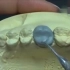 蜡型制作（滴蜡法）——上6 wax up - upper 1ST molar