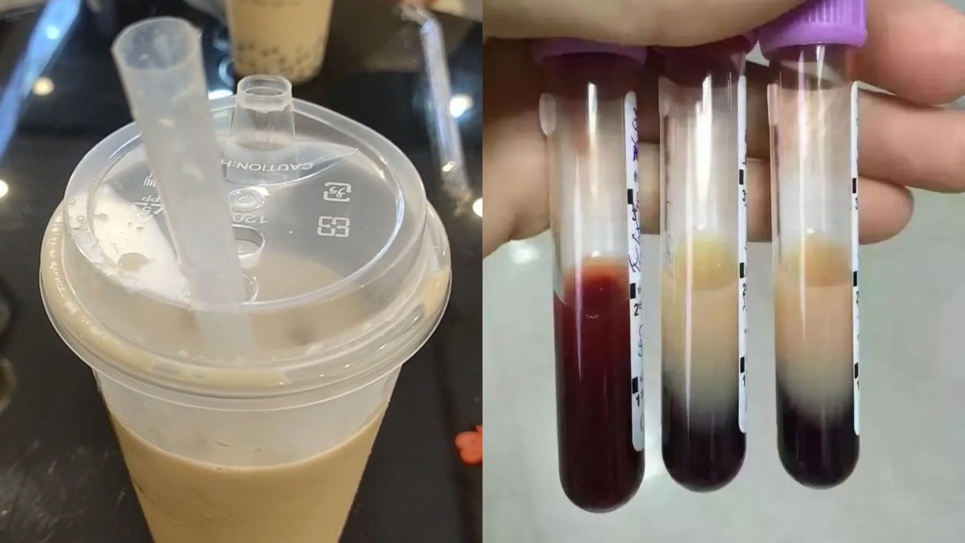 糖尿病小伙0元购奶茶喝出牛奶血，网友神评论：外卖省的钱都送急诊了