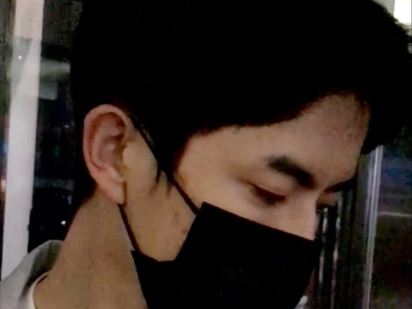 于朦胧2020如果妈妈看到这样那得多扎心啊。这样的疤痕到底是怎么造成的