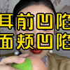 如何改善耳前凹陷，面颊凹陷，面部凹陷，面部外轮廓不流畅
