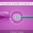第四代试管婴儿:卵胞浆置换GVT技术,3D动画高清展示核移植过程Germinal Vesicle Transfer！