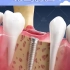 武汉德韩口腔为您介绍种植牙的全过程!